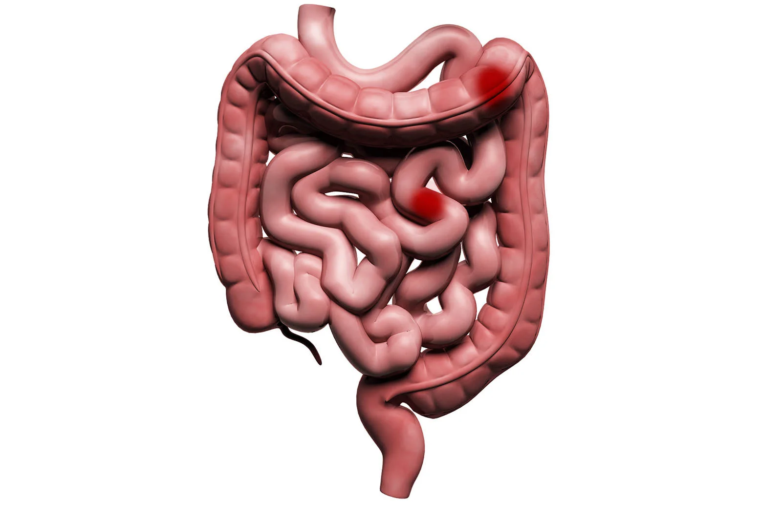 Doctor performing Colonoscopy